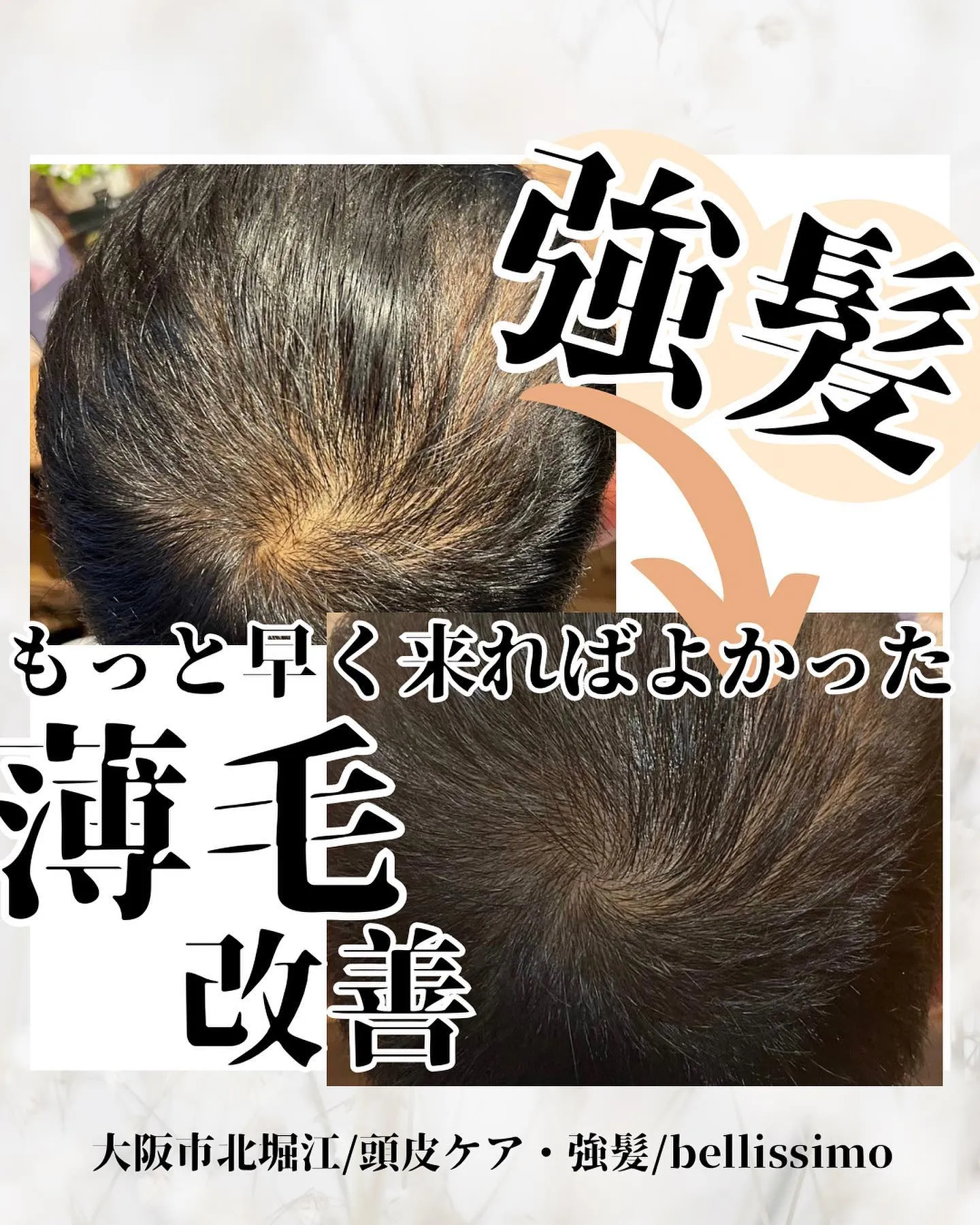 大阪市西区で頭皮ケア、強髪で薄毛改善もできるエステサロン