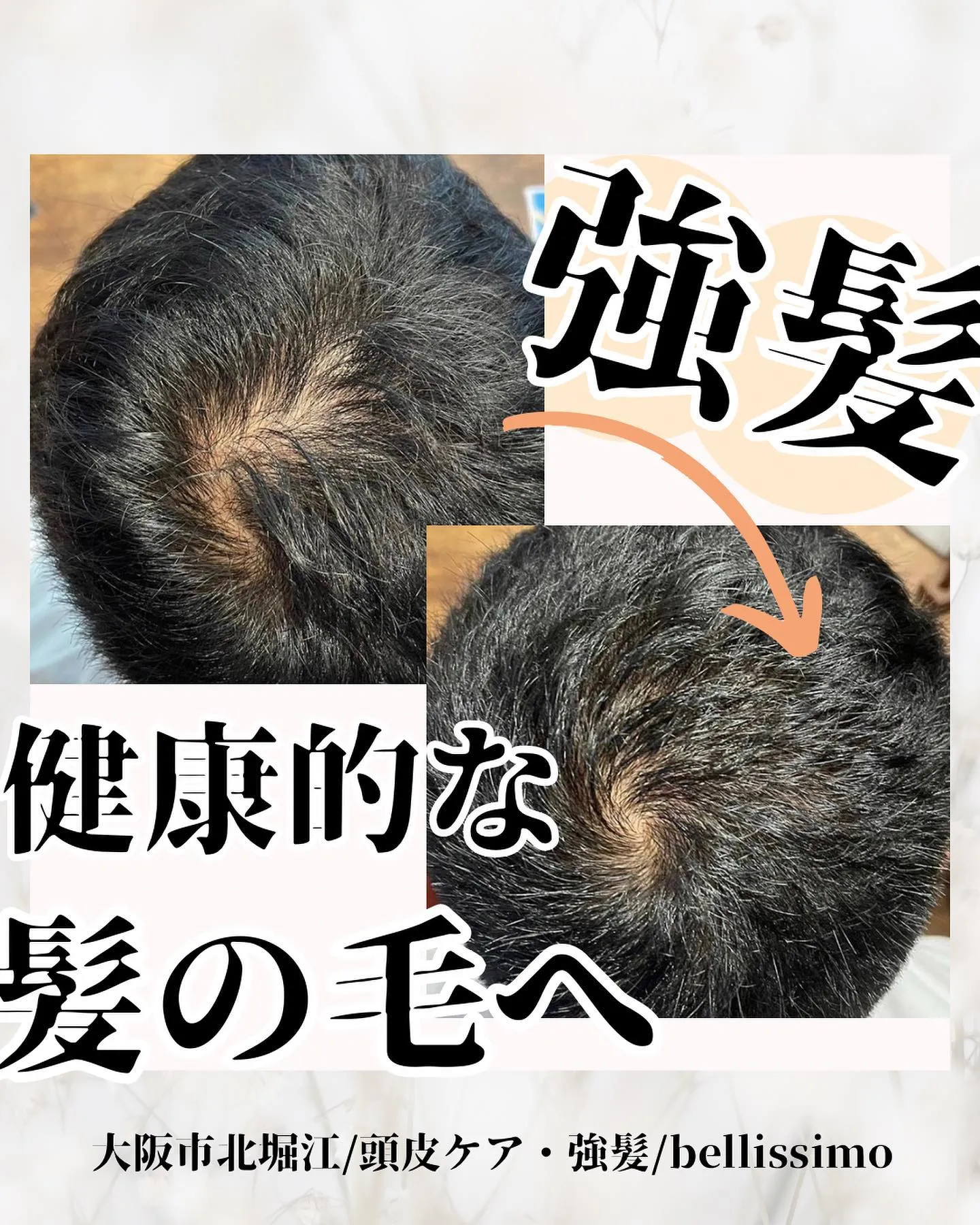 大阪市西区で強髪、ひっそり頭皮ケアができるプライベートエステ...