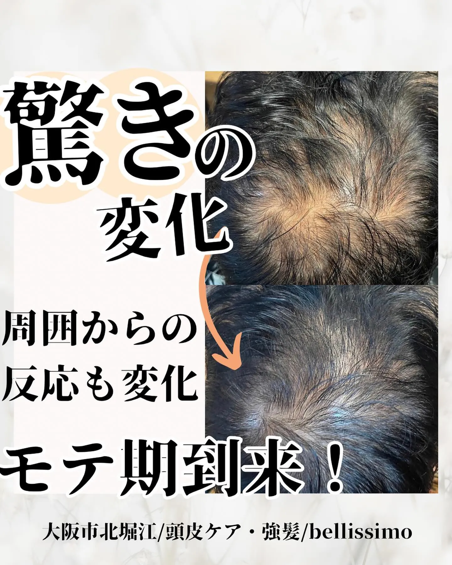 大阪市西区で頭皮ケア、薄毛改善ができるプライベートエステサロ...