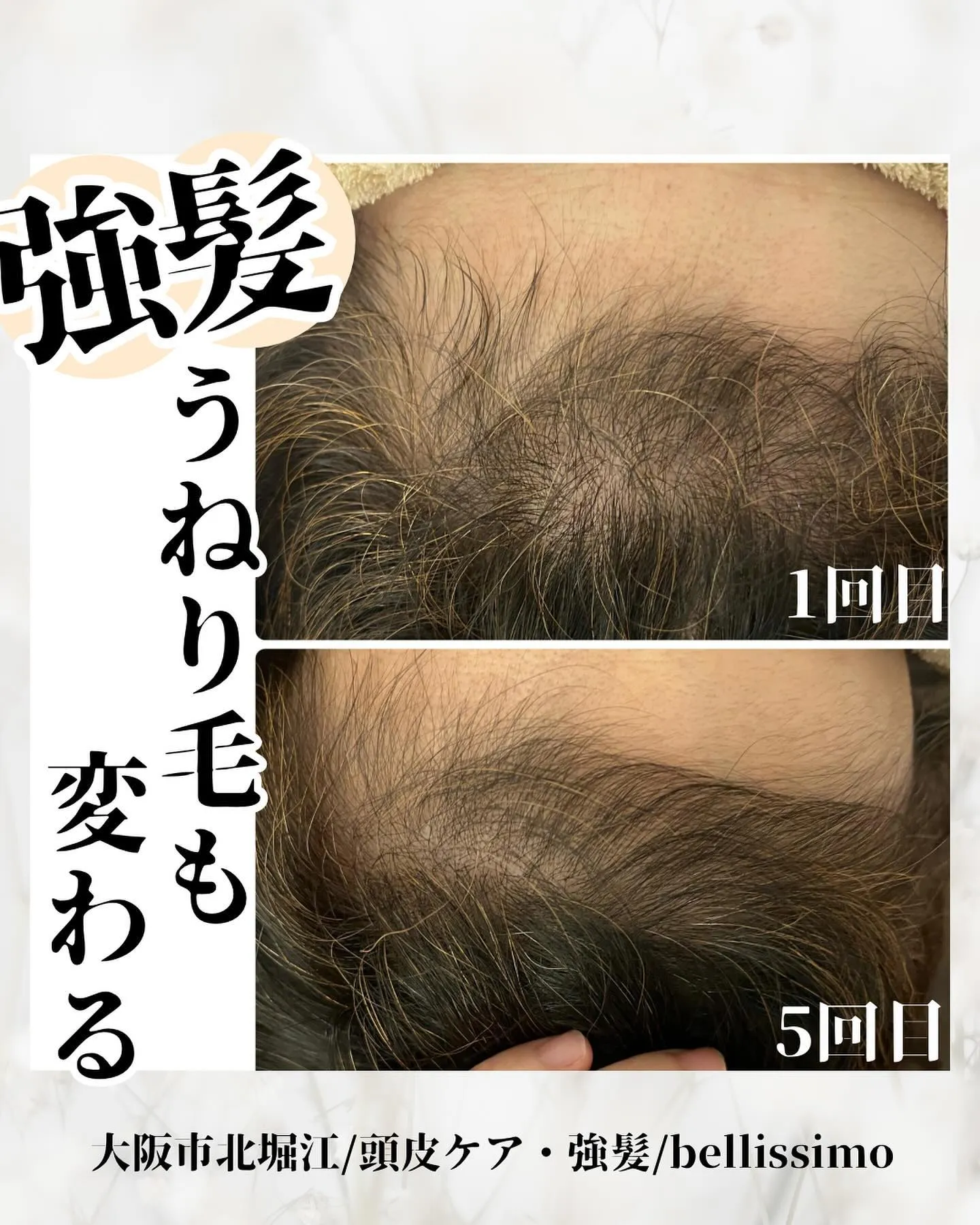大阪市西区堀江で強髪、抜け毛改善できるエステサロン