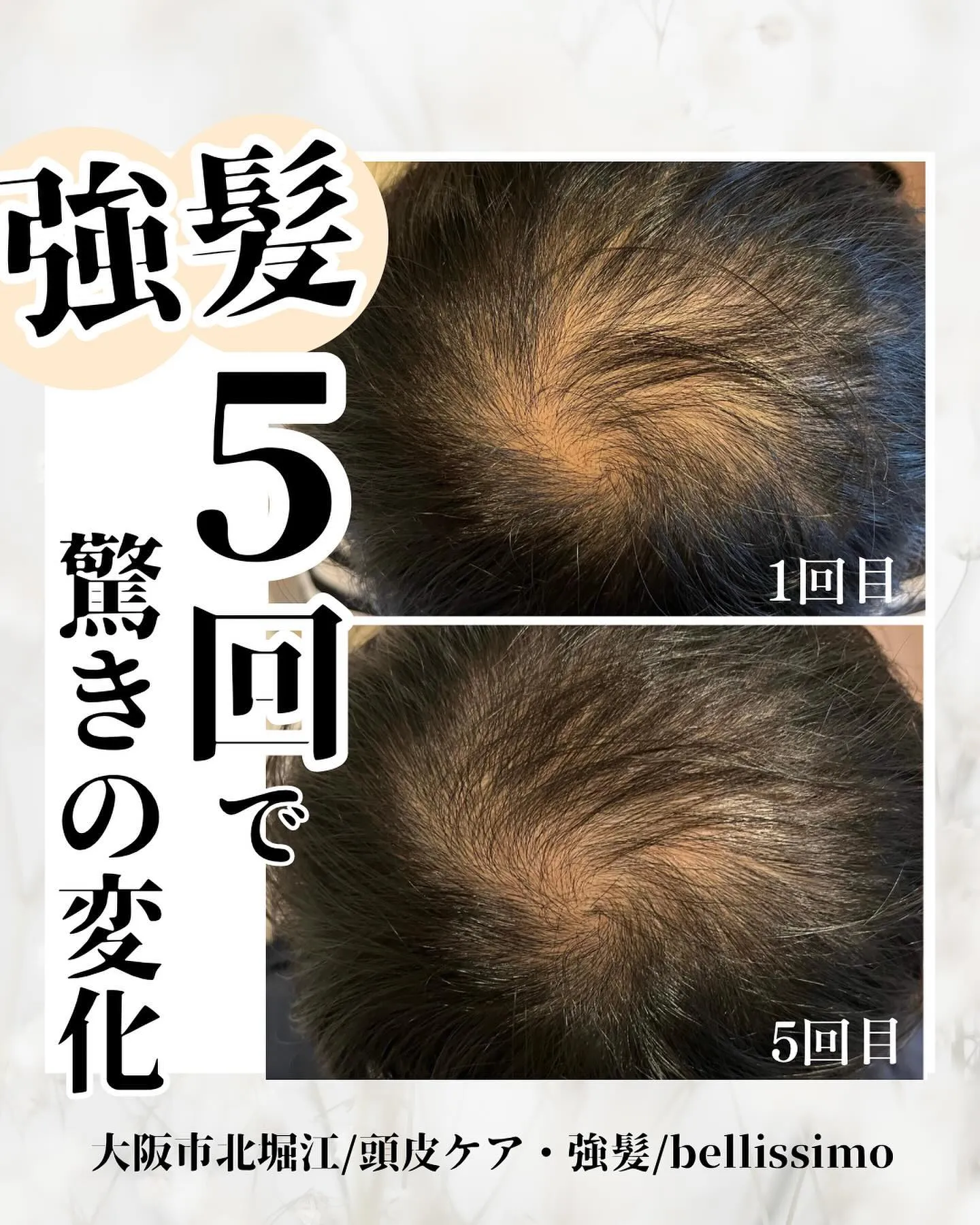 大阪市西区で薄毛改善、強髪を取り入れているエステサロン