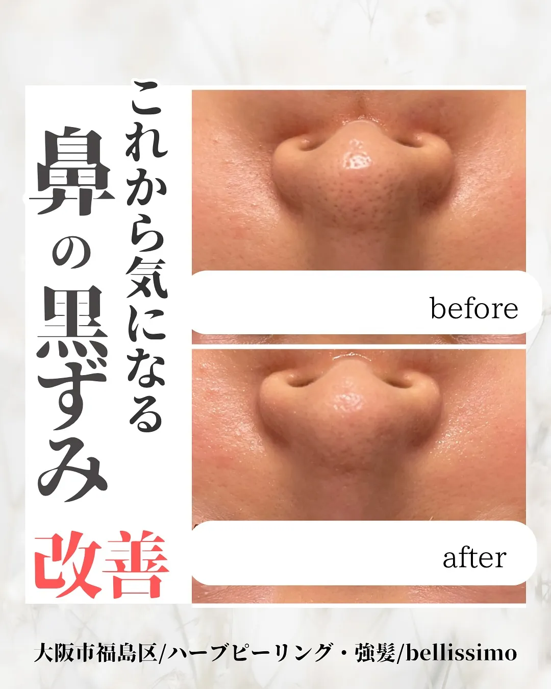 これからの季節気になる鼻の黒ずみ改善ハーブピーリング🌿