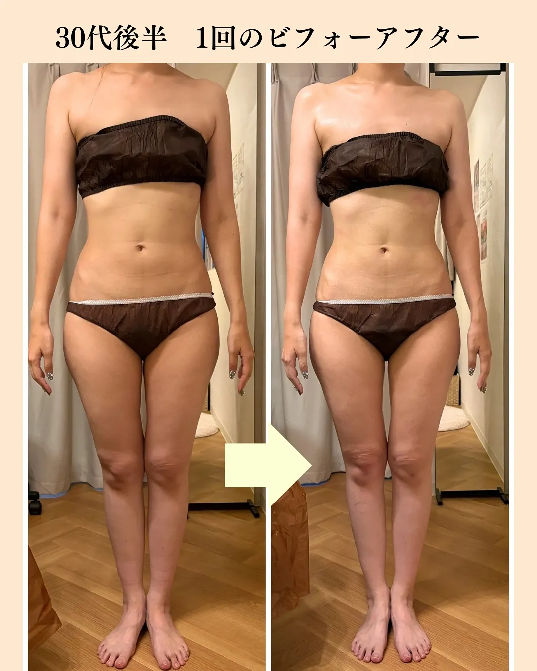 ＼たった1回でこの変化🔥／