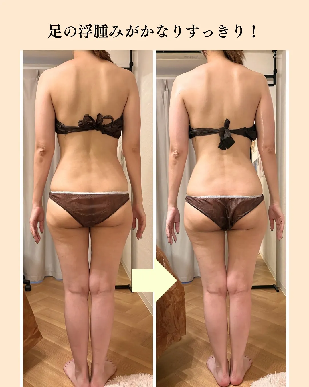 ＼たった1回でこの変化🔥／