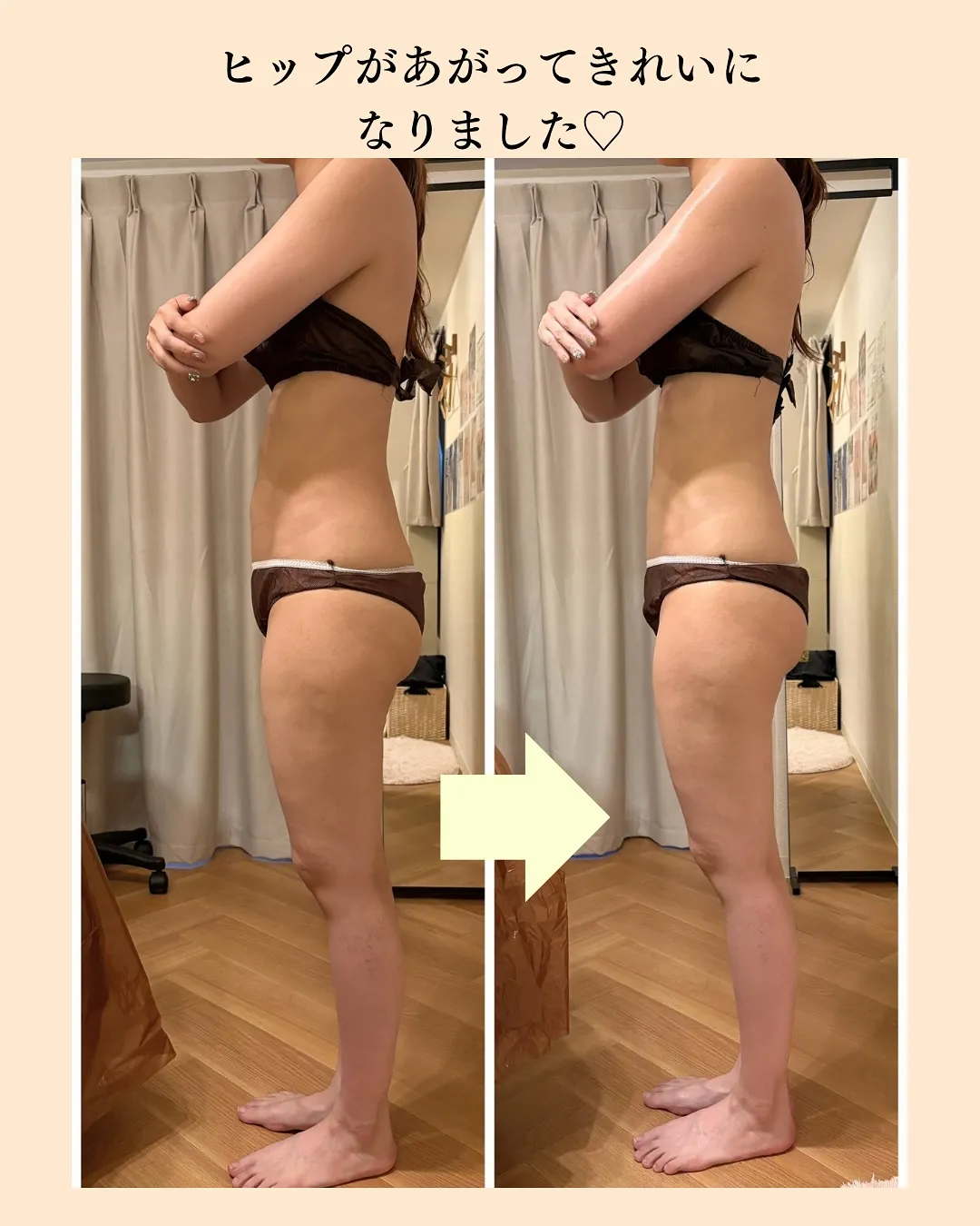 ＼たった1回でこの変化🔥／