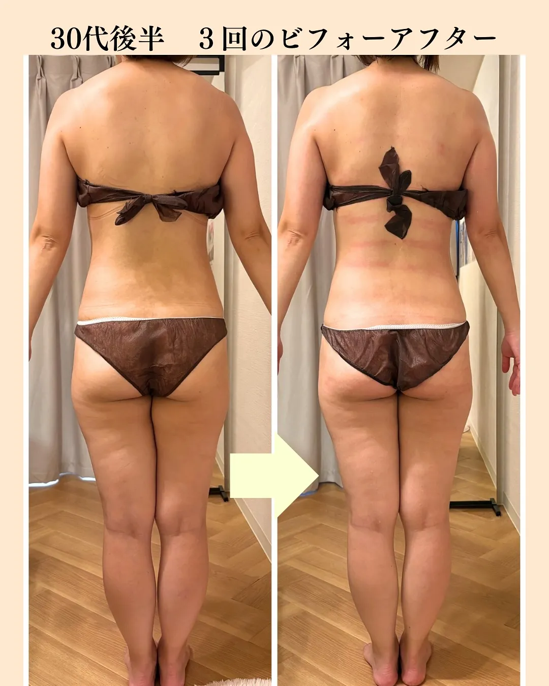 【30代後半こんなお悩みありませんか？】