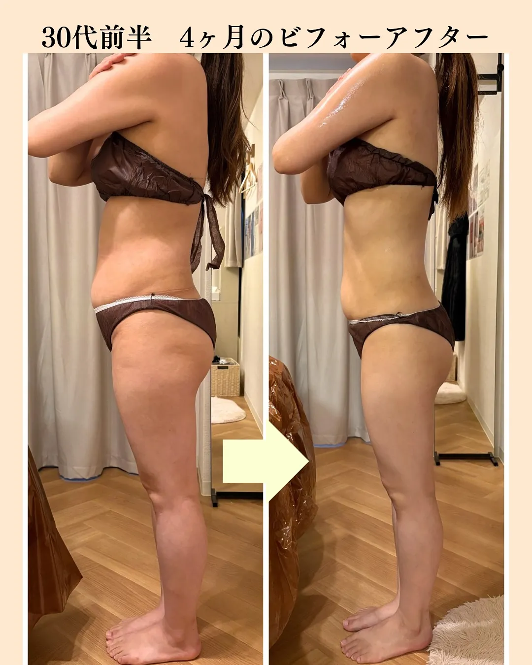 💍ブライダルエステ💍