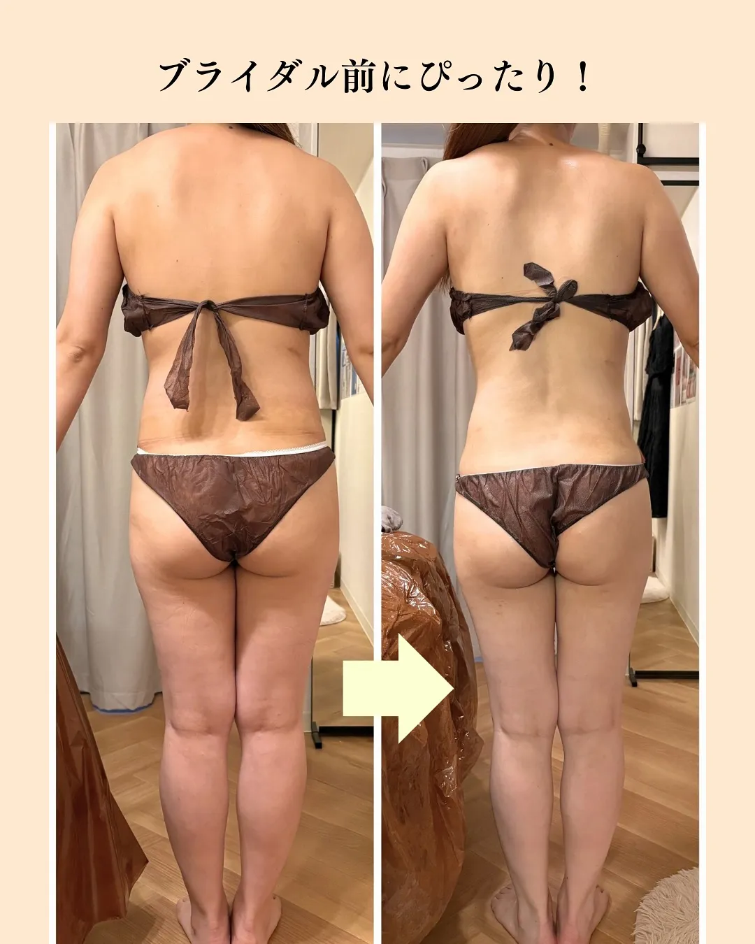 💍ブライダルエステ💍